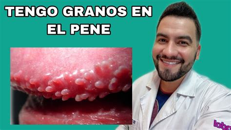 granitos en el oene|Granos o bolitas en el pene: 12 causas y cómo tratar (con fotos)